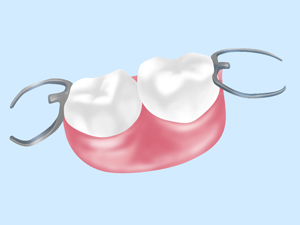 義歯について（入れ歯）