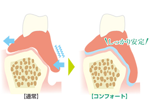 コンフォートを使用